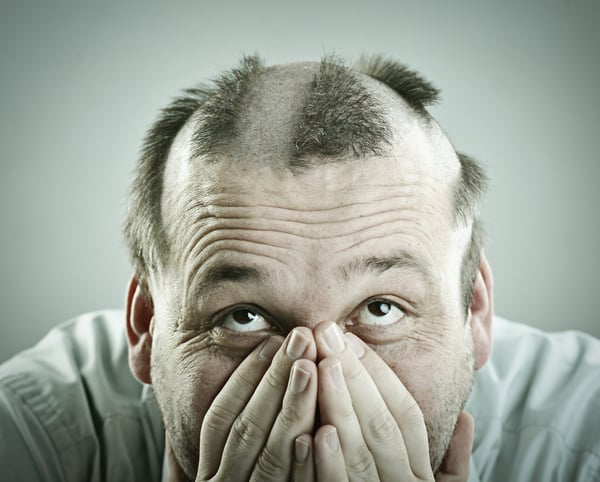 Man with funny silly half bald hair